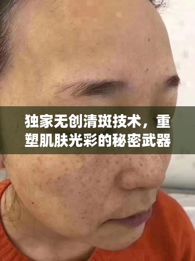 独家无创清斑技术,重塑肌肤光彩的秘密武器!