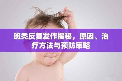 斑秃反复发作揭秘,原因、治疗方法与预防策略